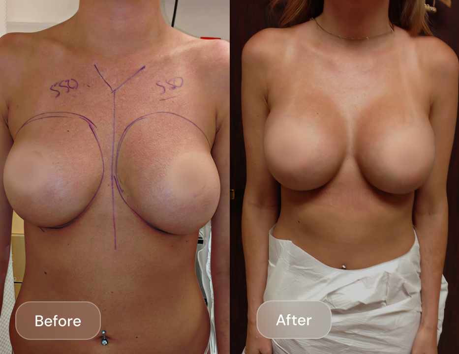 Client result