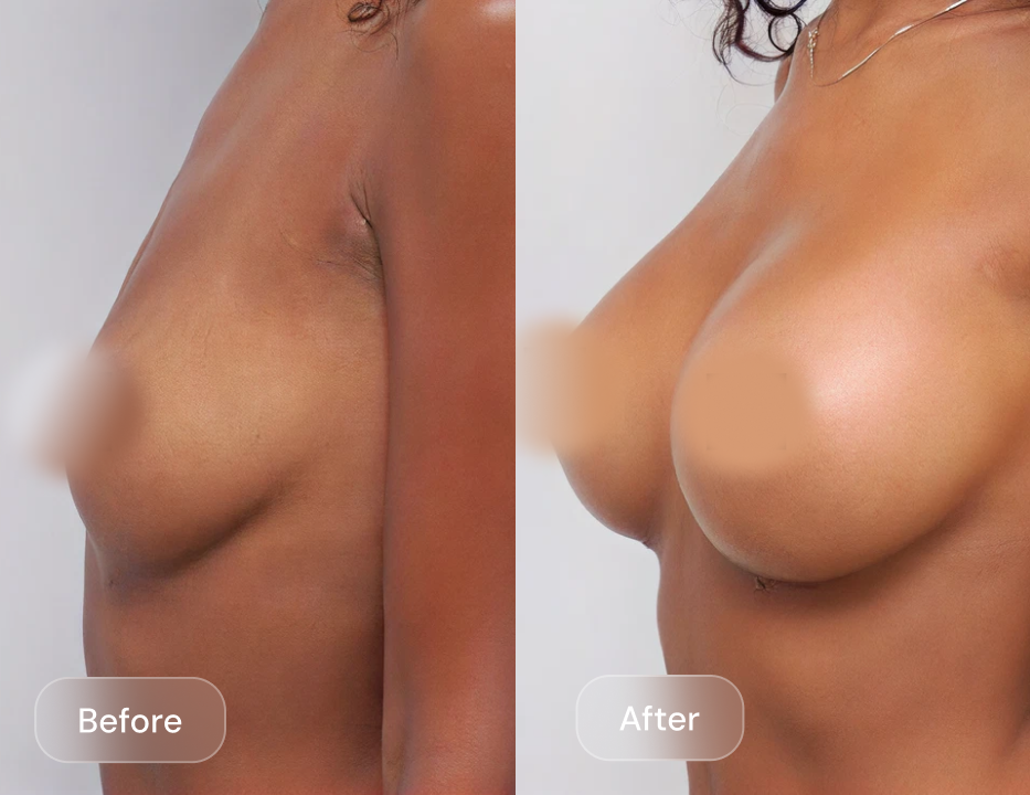 Client result