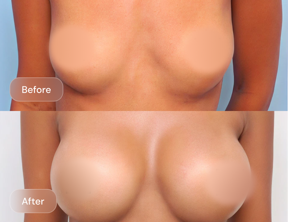 Client result