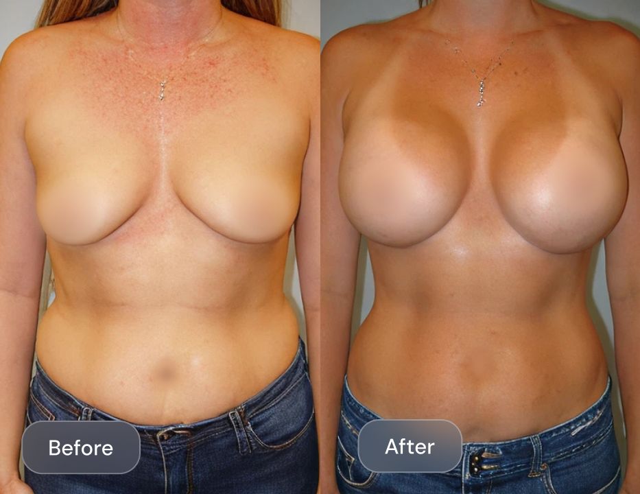 Client result